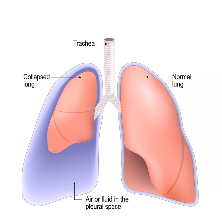 Pneumology